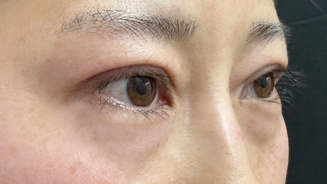 手术前的状态 其一