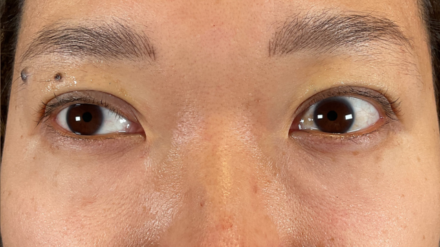 Postoperative Condition Part 1