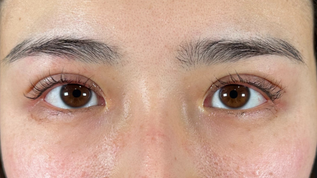 手术前的状态 其一