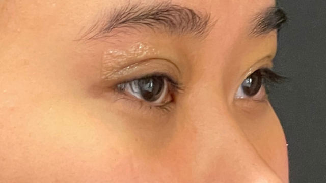 手術前の状態 その1