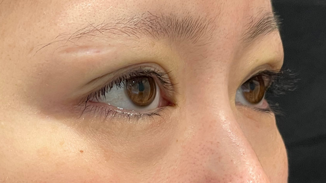 Postoperative Condition Part 1