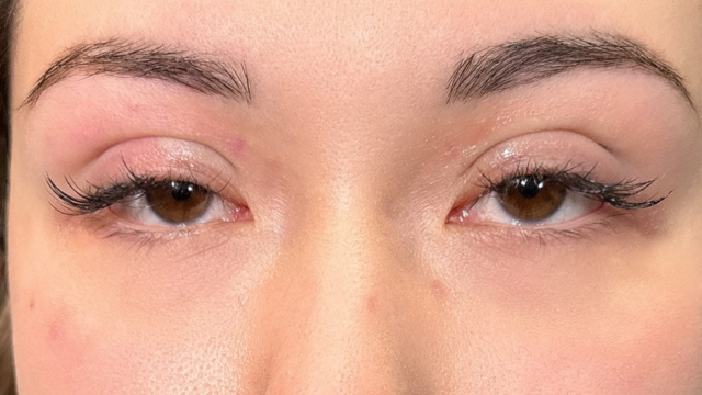 手术前的状态 其一