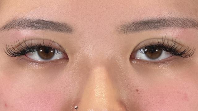 手術前の状態 その1