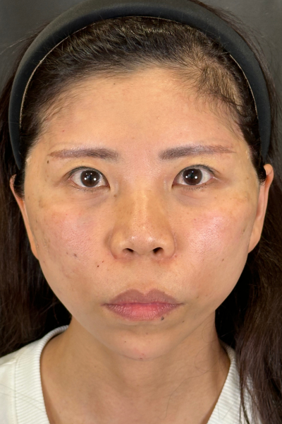 手術前の状態 その1