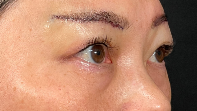 Postoperative Condition Part 1