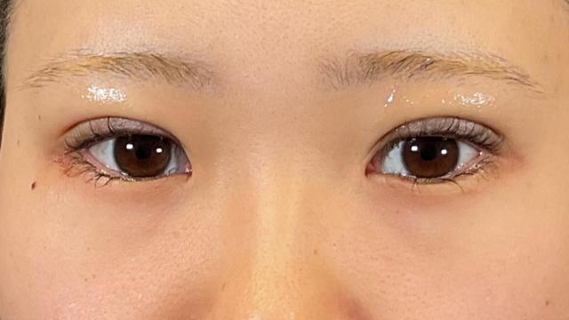 Postoperative Condition Part 1