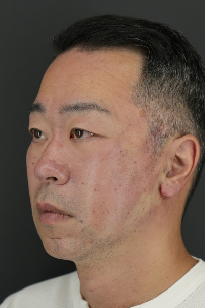 手術前の状態 その1