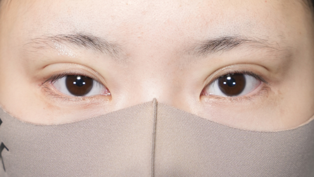 手术前的状态 其一