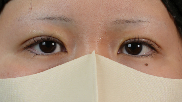 Postoperative Condition Part 1