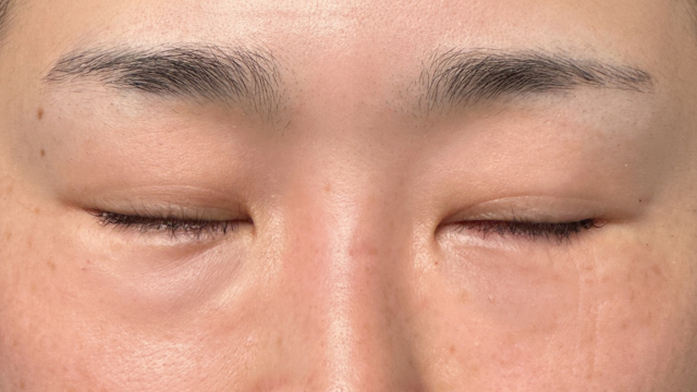 手术前的状态 其一