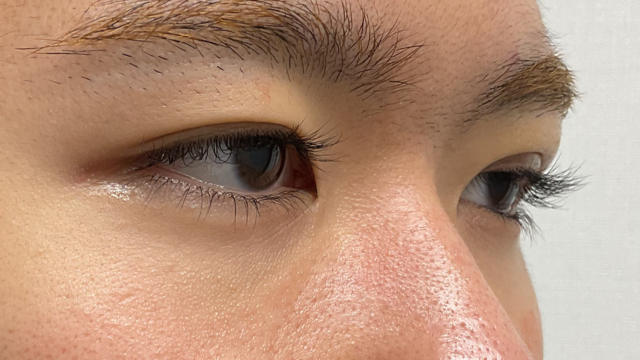 Postoperative Condition Part 1