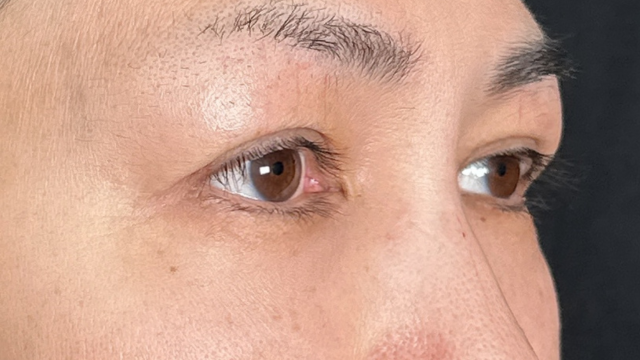 手术前的状态 其一