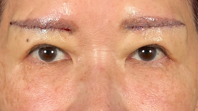 手術前の状態 その1