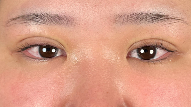 手术前的状态 其一