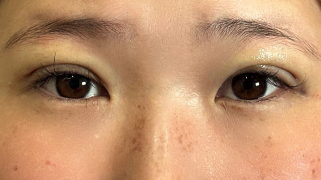 Postoperative Condition Part 1