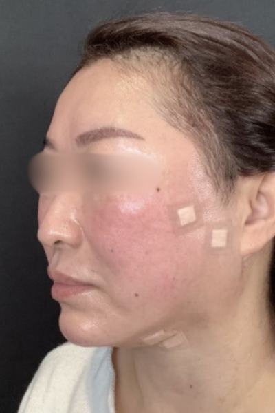 手術前の状態 その1