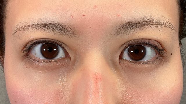 手术前的状态 其一