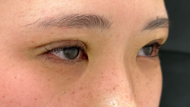 手术前的状态 其一