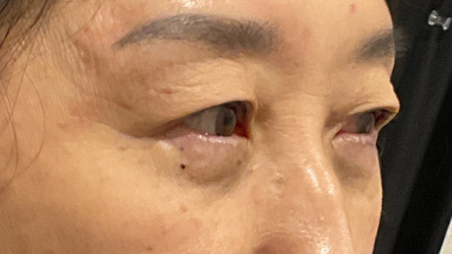 手术前的状态 其一