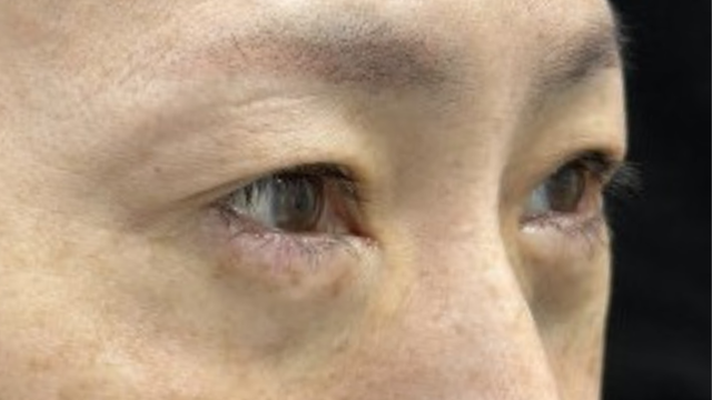 手术前的状态 其一