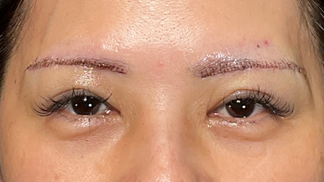 Postoperative Condition Part 1