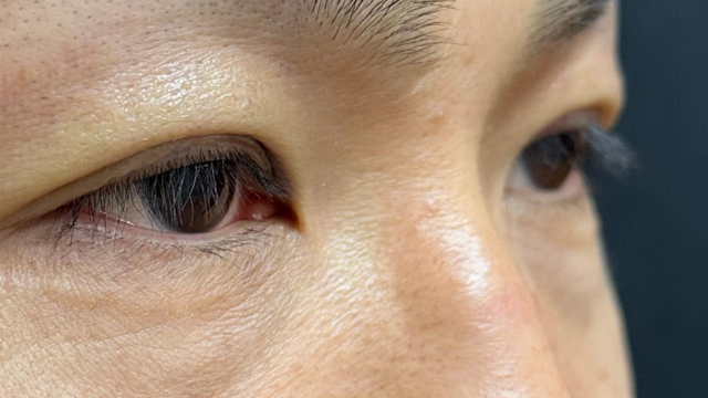 手术前的状态 其一