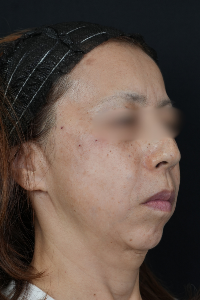 手術前の状態 その1