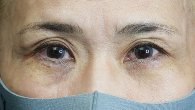 手术前的状态 其一