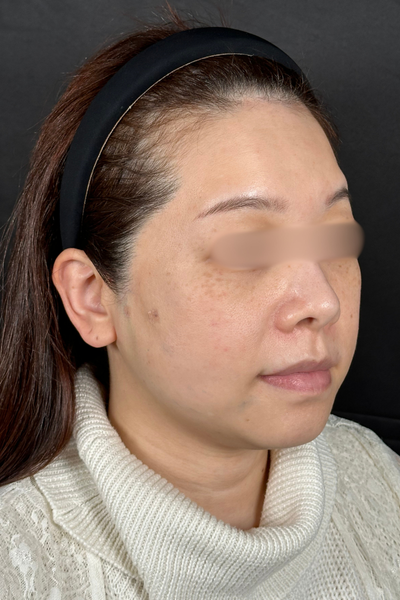 手術前の状態 その1