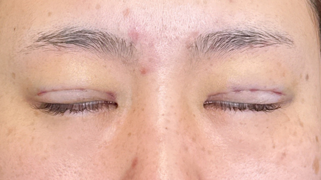 手术前的状态 其一