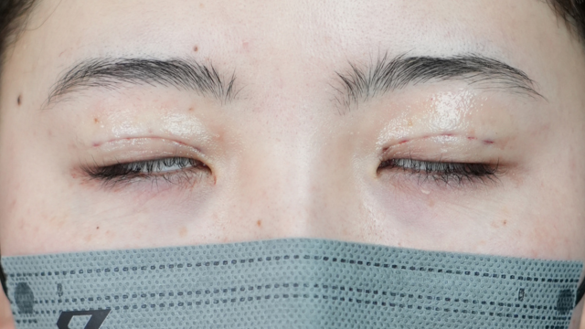 Postoperative Condition Part 1