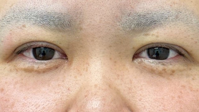 Postoperative Condition Part 1