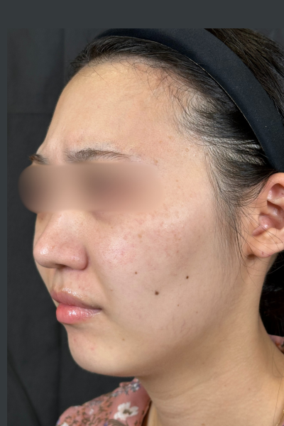 手術前の状態 その1