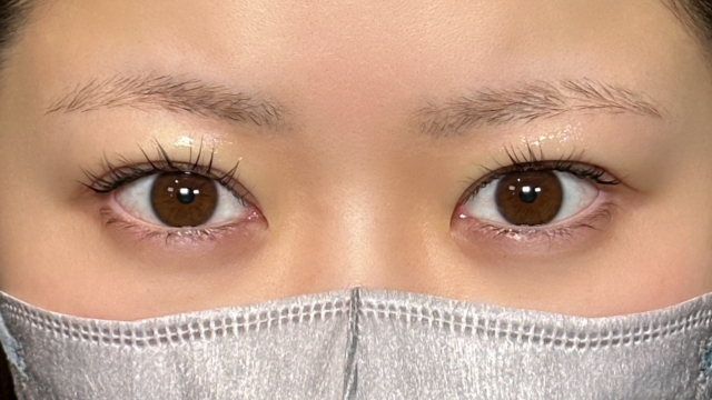 手术前的状态 其一