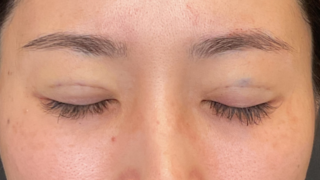 手术前的状态 其一