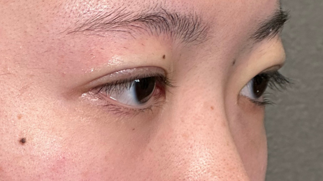 手术前的状态 其一