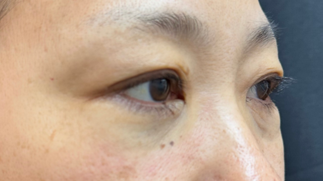 Postoperative Condition Part 1