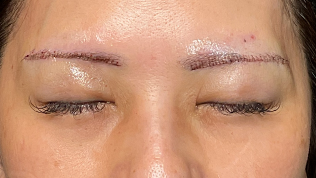 Postoperative Condition Part 1