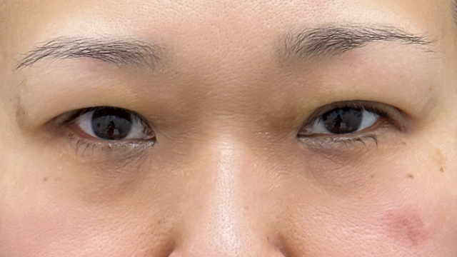 Postoperative Condition Part 1