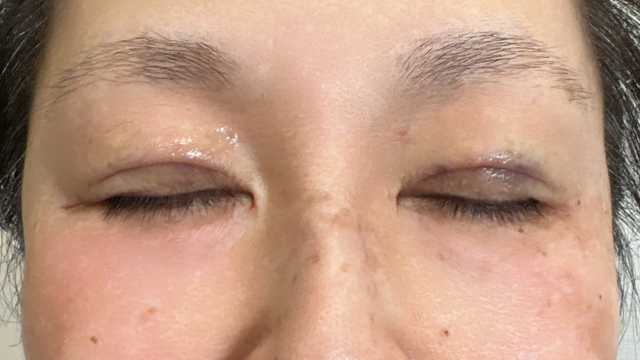 手术前的状态 其一