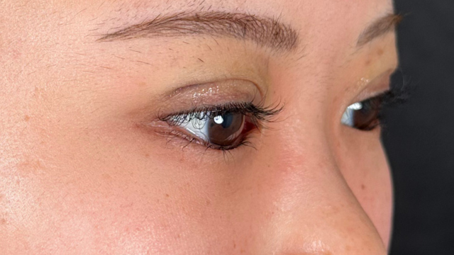 手术前的状态 其一