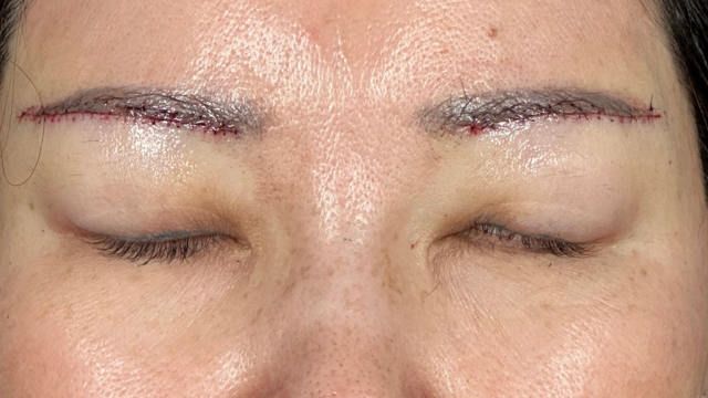 Postoperative Condition Part 1