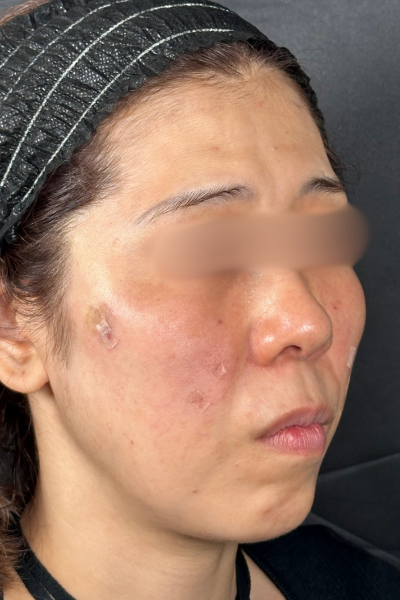 手術前の状態 その1