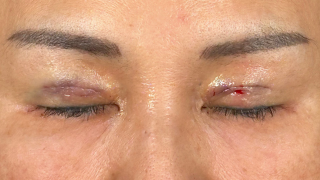 Postoperative Condition Part 1