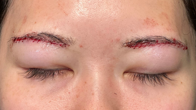 Postoperative Condition Part 1