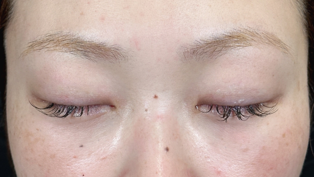 手术前的状态 其一