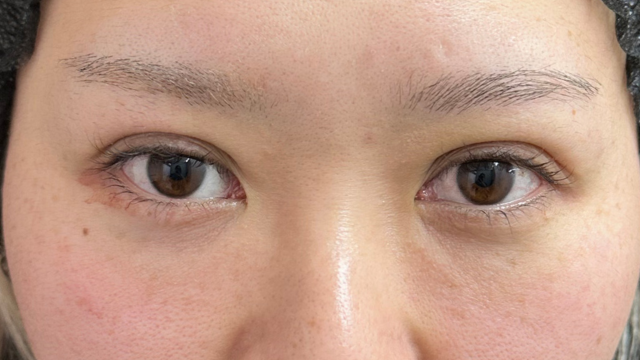 手术前的状态 其一