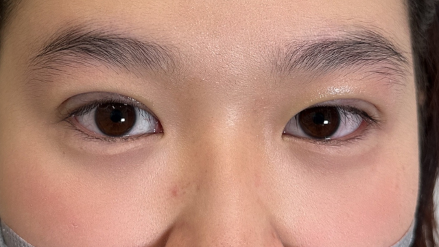 手术前的状态 其一