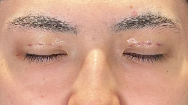 Postoperative Condition Part 1