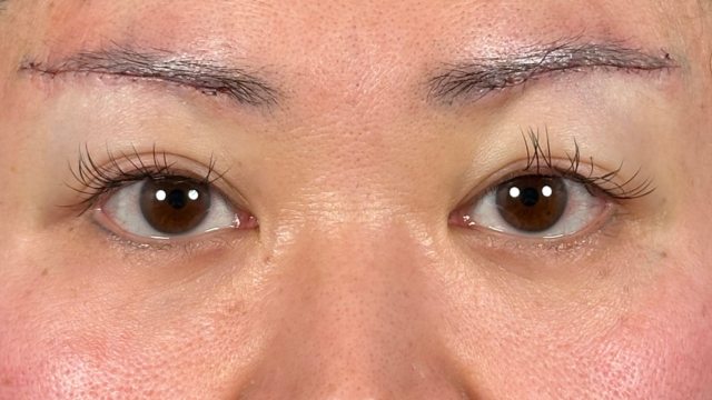 Postoperative Condition Part 1